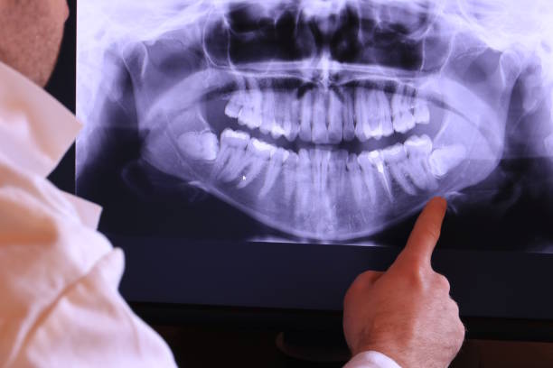 Best Emergency Treatment for Dental Infections or Abscesses in Bridgeport, NE