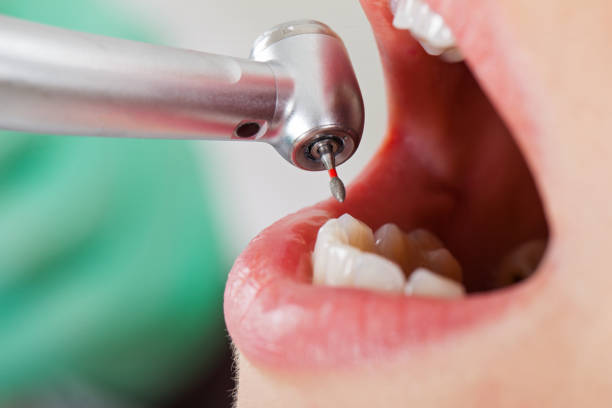 Best Emergency Gum Treatment in Bridgeport, NE